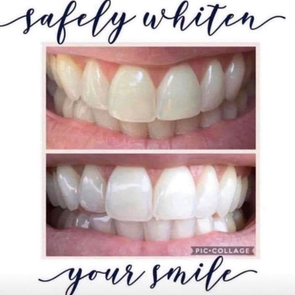 Whitening Toothpaste 🦷 - Picture 3 of 8